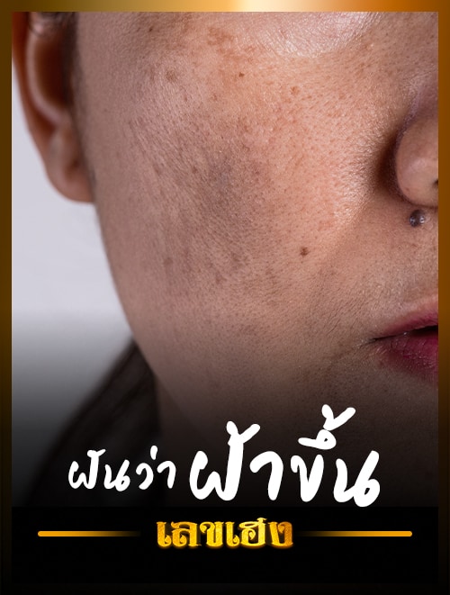ฝันว่าฝ้าขึ้นบนใบหน้า